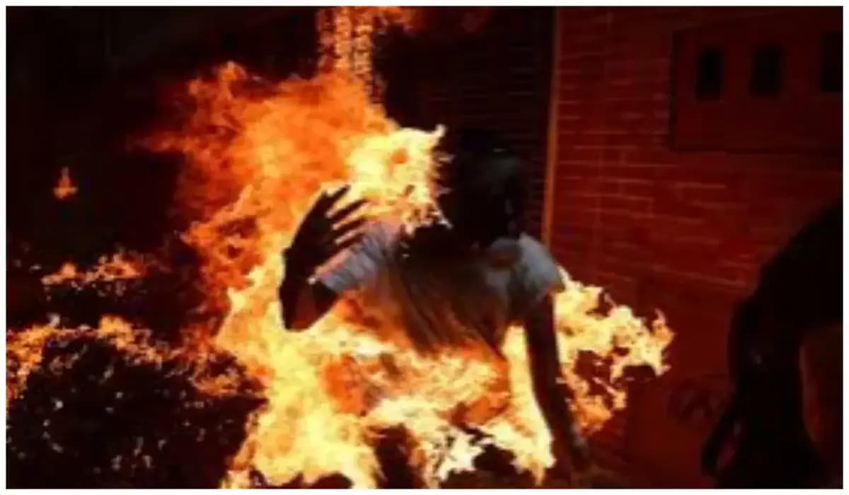 Zimbabwe: elle écope de 10 ans de prison pour avoir brà»lé vif son mari