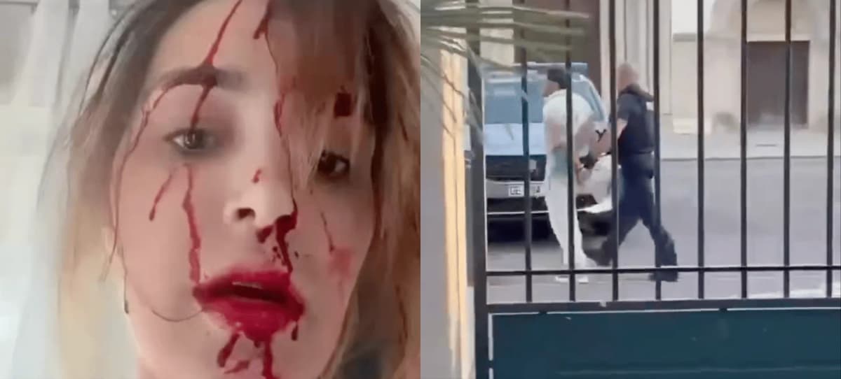 Cannes 2026 : une Miss violemment agressée dans sa chambre d’hôtel, son visage en sang dévoilé, son styliste interpellé